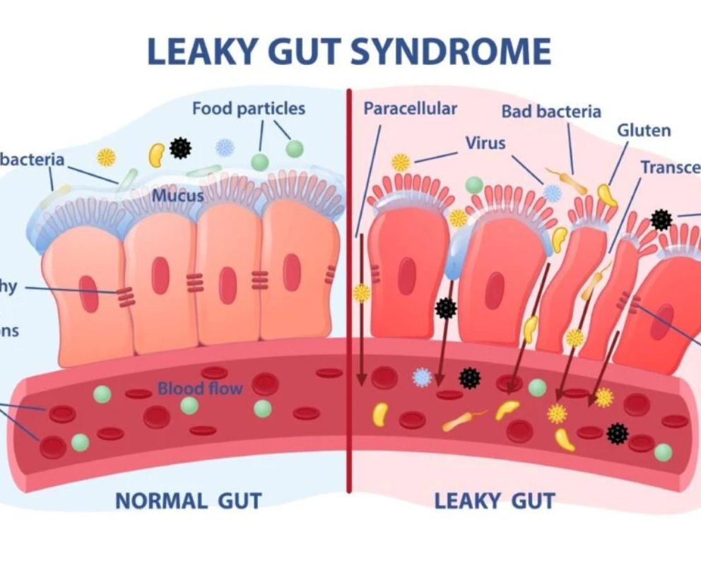 Dieta ormonale : Permeabilità intestinale e fertilità